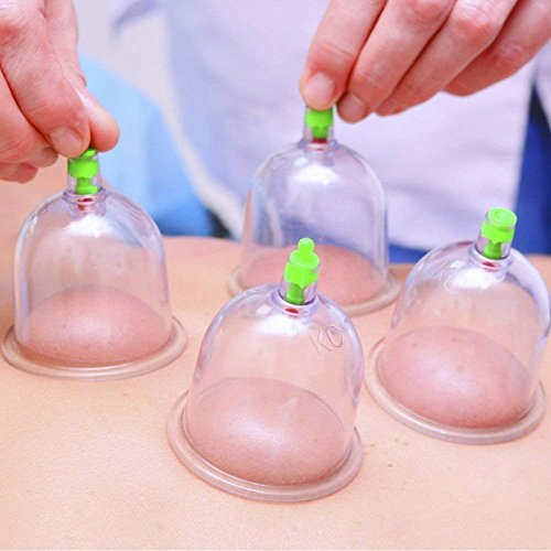 Vakum Masažar Sa Pumpom i 12 VENTUZA Vakum Masažar Sa Pumpom i 12 VENTUZA